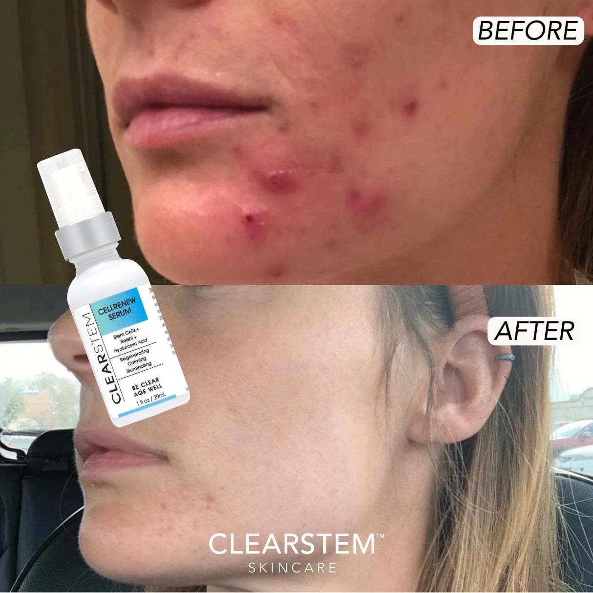 CLEARstem CELLRENEW Serum 