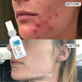 CLEARstem CELLRENEW Serum 